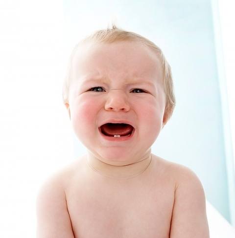 Viêm lợi cấp thường xảy ra sau khi trẻ mọc răng