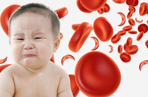 trẻ thiếu máu khi sốt là bình thường