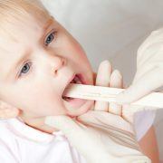 biến chứng viêm họng ở trẻ em